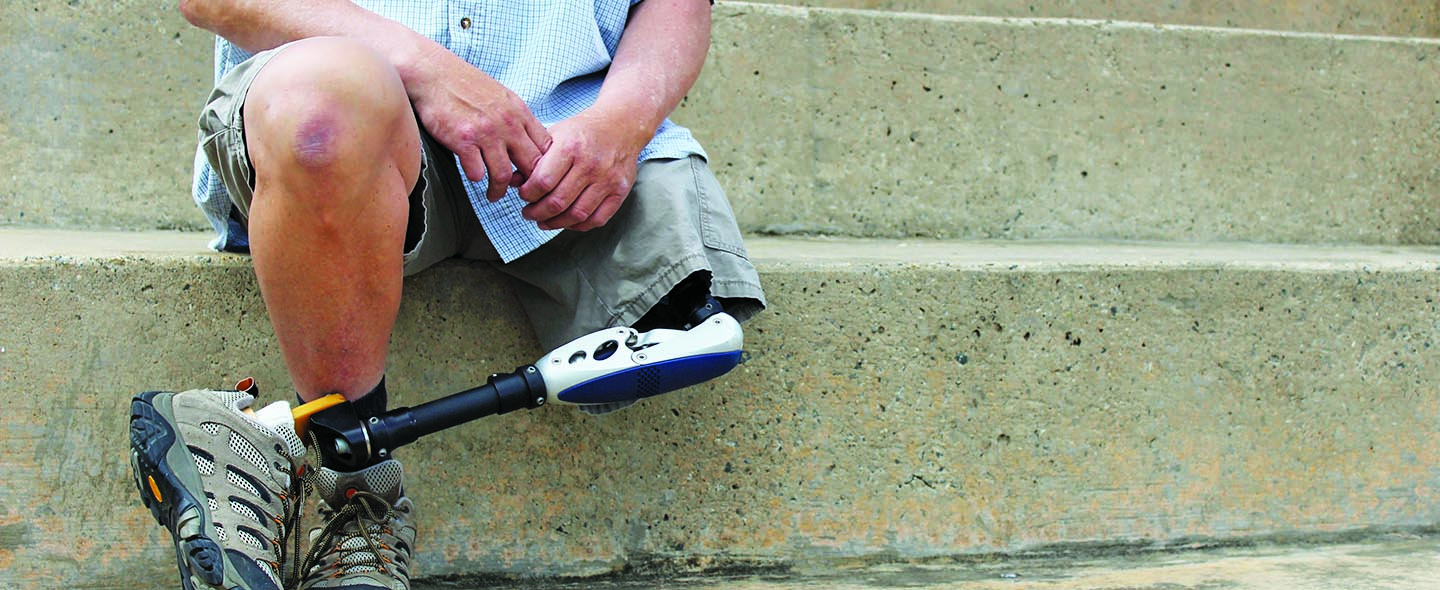 Man sitting with a prosthetic leg